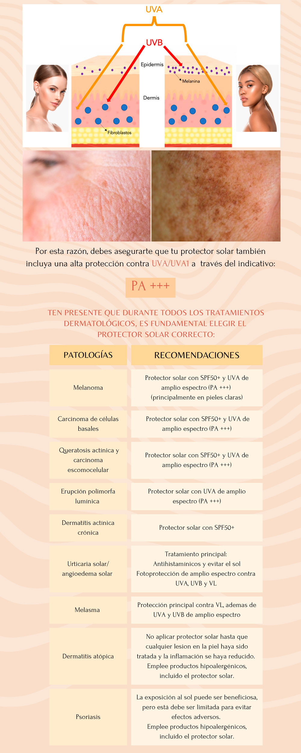 Fototipos cutaneos y proteccion solar 2